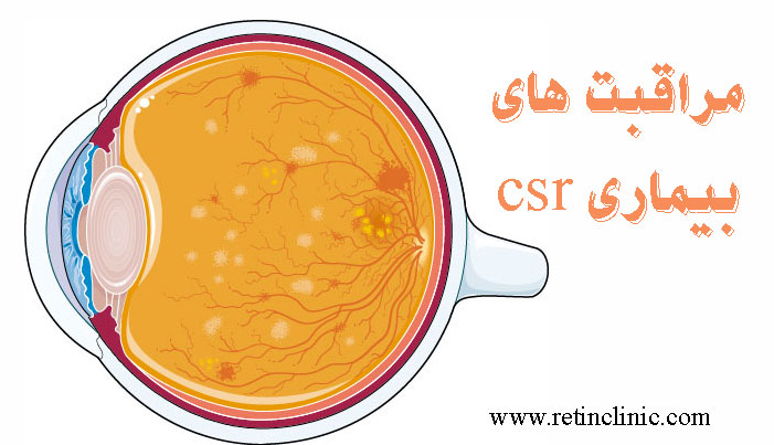 مراقبت های بیماری csr