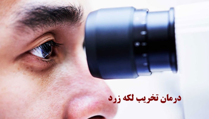 درمان تخریب لکه زرد