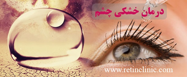 درمان خشکی چشم