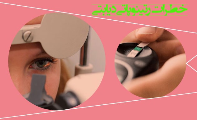 خطرات رتینوپاتی دیابتی