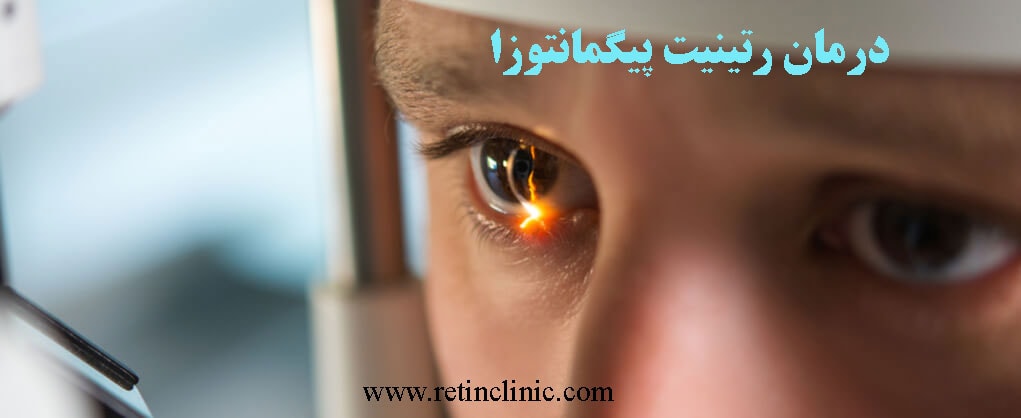 درمان رتینیت پیگمانتوزا